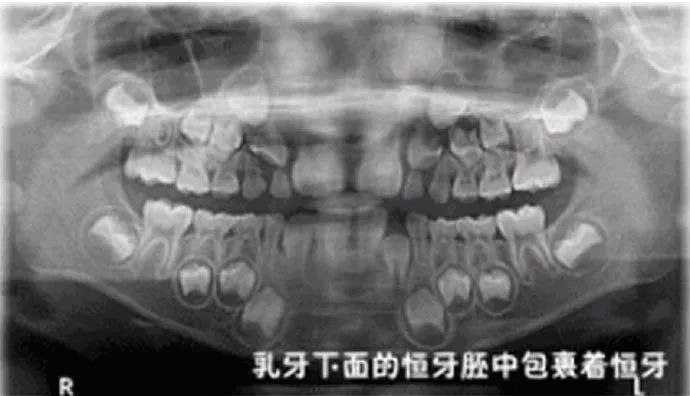 大连齿医生口腔科普 为啥看牙一定要拍x光片?辐射不可怕吗?