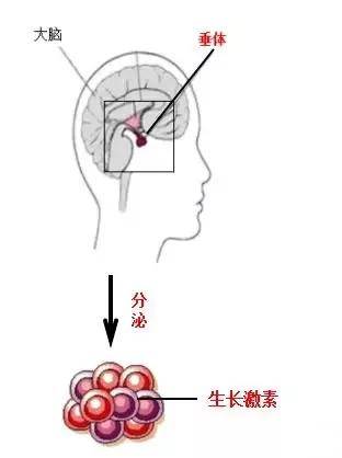 孩子|自卑小伙去国外“断骨增高”！结果面临终身残疾为长到1米8