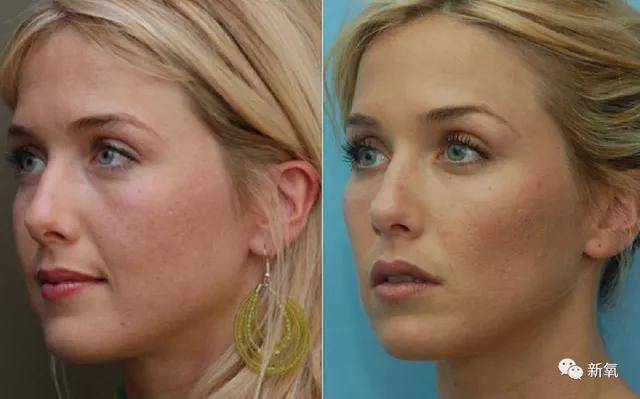 西方|东西方顶级神颜都共用同一张脸?