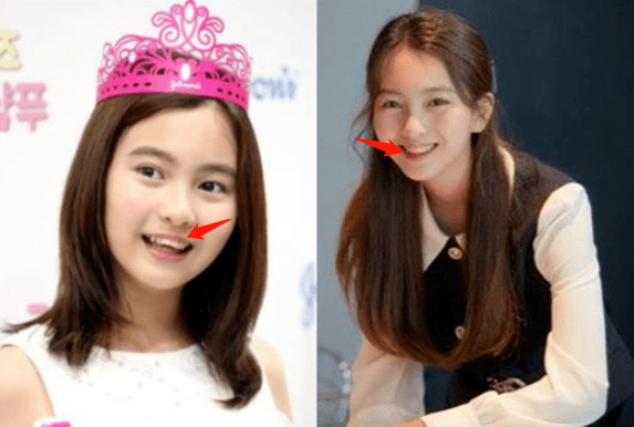 肤色|曾经全网为她哭瞎眼，如今带着一张惊艳众人的脸杀回来了