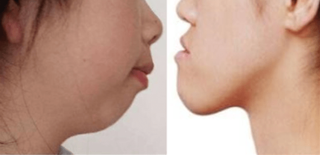 肤色|曾经全网为她哭瞎眼，如今带着一张惊艳众人的脸杀回来了