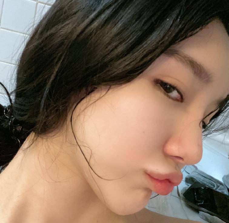 植发|继蔡萝莉之后，艾比也被爆出整容植发，清纯形象再也找不到了