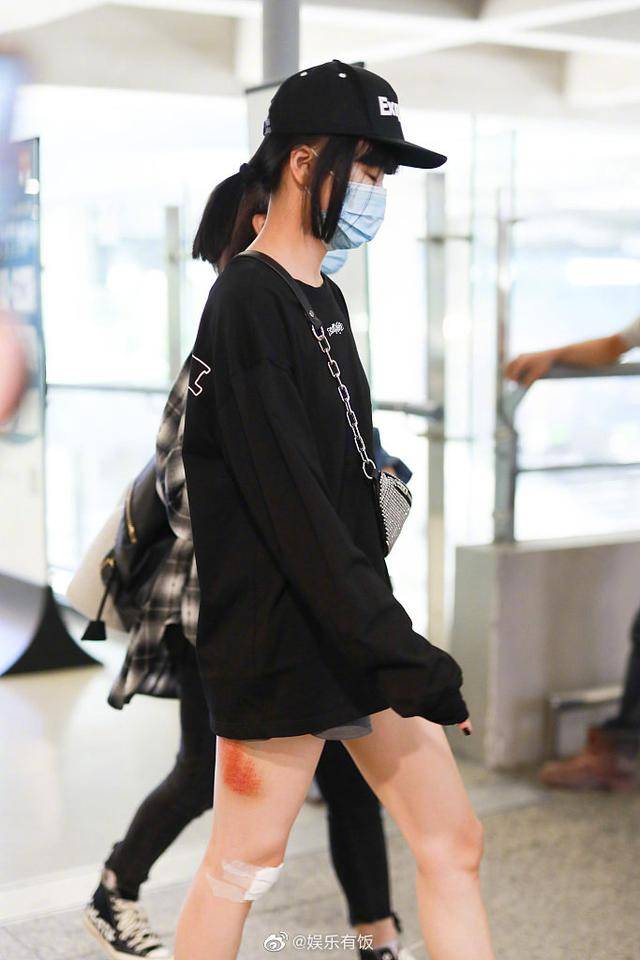 伤痕|黄龄摔倒后首现身，腿蒙着纱布伤痕明显，网友：这看上去就好痛啊