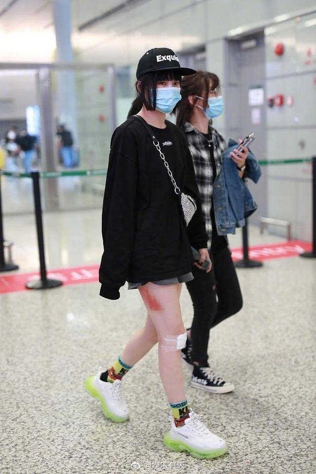 伤痕|黄龄摔倒后首现身，腿蒙着纱布伤痕明显，网友：这看上去就好痛啊