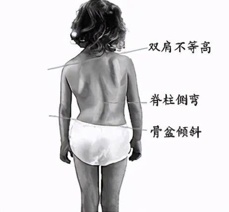 什么是进行性肌肉委缩 46ab00ae0611422a8d5d1cf58efa11ba.jpeg