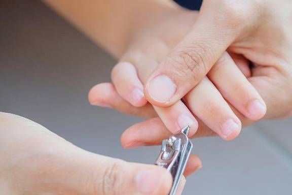 处理|形成原因值得家长关注孩子手指总是长倒刺？不小心处理易感染