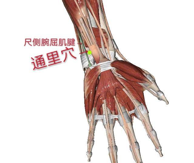 通里穴在前臂掌侧,当尺侧腕屈肌腱的桡侧缘,腕横纹上1寸.
