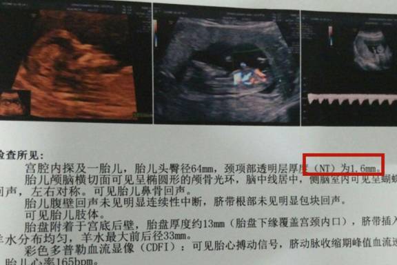 什么时候查胎儿心跳 03e9bf604bfa43eb94b9f2b1ddb2333f.jpeg