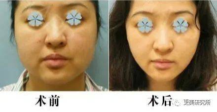 fa|鞠婧祎终于对上晚晚！两个镜头“造假精”，谁能艳压？