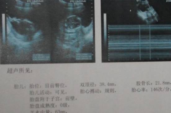 结果|孕妈孕检时，若怀的是男宝，多数会有孕检结果，快来自测一下