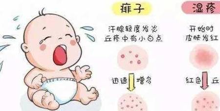 宝宝|不同情况不同应对方式，新妈妈要学学！新生儿常见的四种疹子