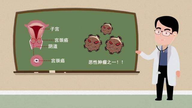 女性感染hpv,只因"不检点"?别逗了!这次跟你说说清楚!