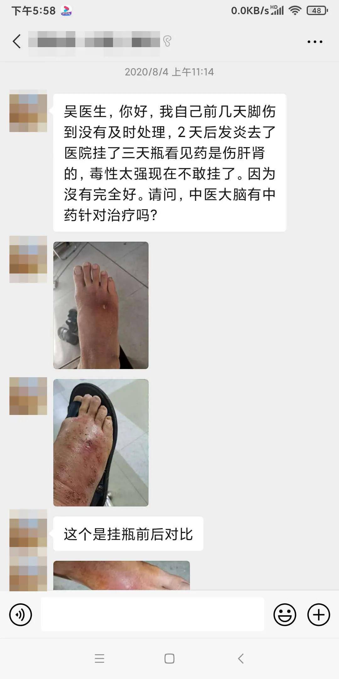 外伤脚肿怎么办