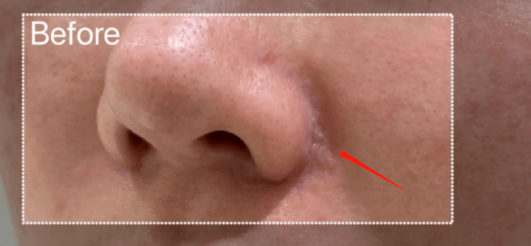 土豆|自己整成馒头脸,还教粉丝瞎整,她这不是第一次翻车了…