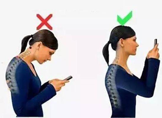 怎么才能使自己不驼背 94bdaac6e8374cc0bfb22ae1fdf3680e.jpeg