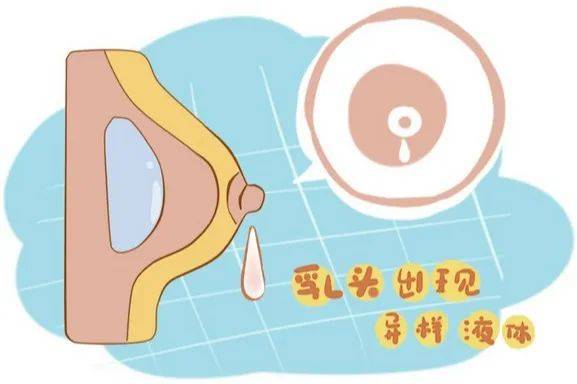 1分钟学会「乳房自检」,拒绝乳腺癌!