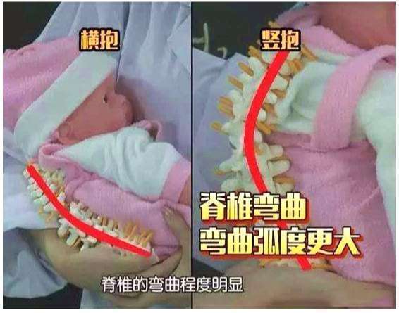 坏处|不要伤娃脊柱两个月宝宝总竖抱有哪些坏处？竖抱娃牢记2点关键