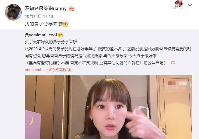 Uzi|UZI女友素颜出镜，整容后颜值爆表，动鼻子就花了10多万