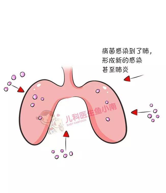 处理|一篇文章学会孩子秋季咳嗽的处理方法