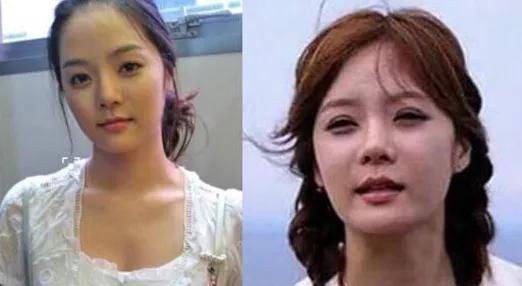 朴敏英|9年换5次头，do得毫无痕迹，双眼皮竟然还都是亲爸割的...