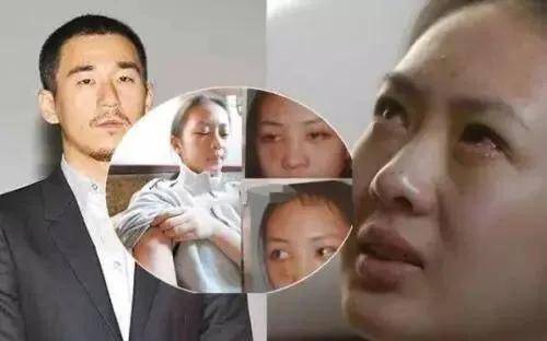 童瑶爆冷获金鹰奖最佳女主!曾被张默毒打丑闻缠