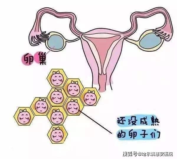 【科普】卵巢发育不良