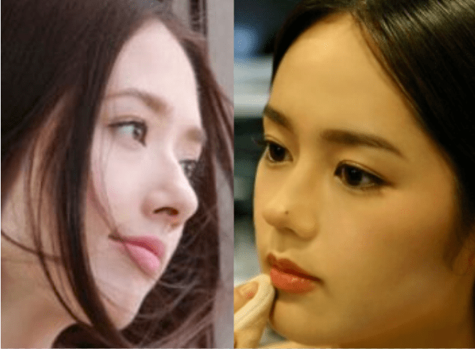 赵丽颖|鞠婧祎和赵丽颖竟然是同一个医生？