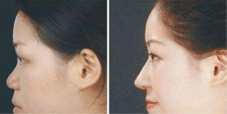 赵丽颖|鞠婧祎和赵丽颖竟然是同一个医生？