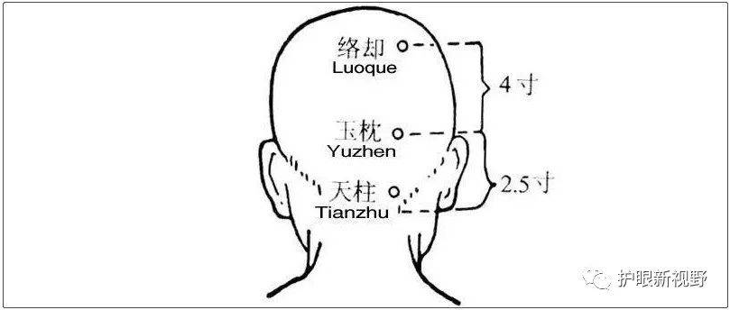 5个穴位治疗近视,青光眼,每天按摩一下