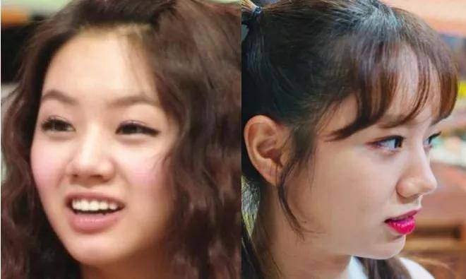 李惠利|女明星最绝大鼻头变身记！娜扎do鼻子前应该找她取经1000次...