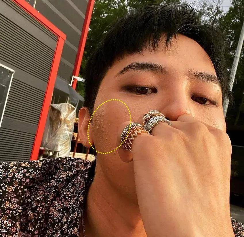 毛孔|权志龙，你真的不能再整了啊...