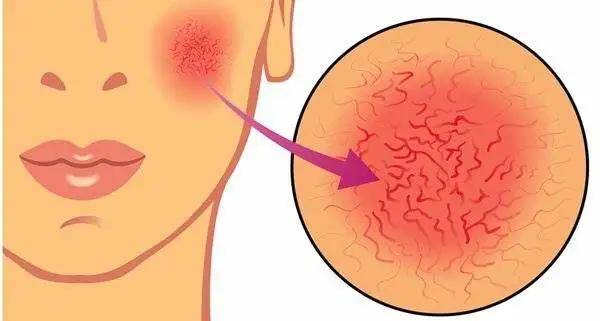 毛孔|权志龙，你真的不能再整了啊...