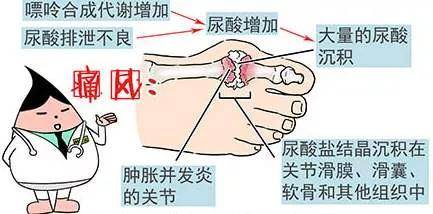 痛风患者能不能吃毛豆?_手机搜狐网