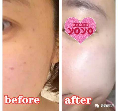 任天王|隐忍10年两任天王嫂杠上热搜！各自成家这么久，怎么还在较劲