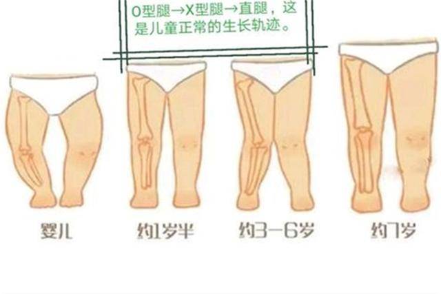 3,过早让宝宝站立行走