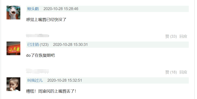 嘴唇|F4重聚，周渝民罕见露面变化太大，上嘴唇变薄将消失，整容还是自然衰老？