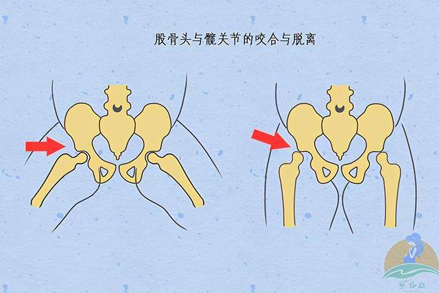 一岁宝宝腿弯怎么办