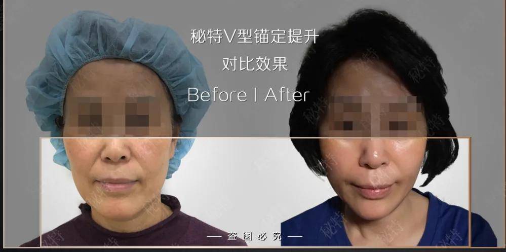 老脸|金晨谈恋爱也太尴尬了！节目组卖力撮合个寂寞……这张不老脸就能胡作非为吗？