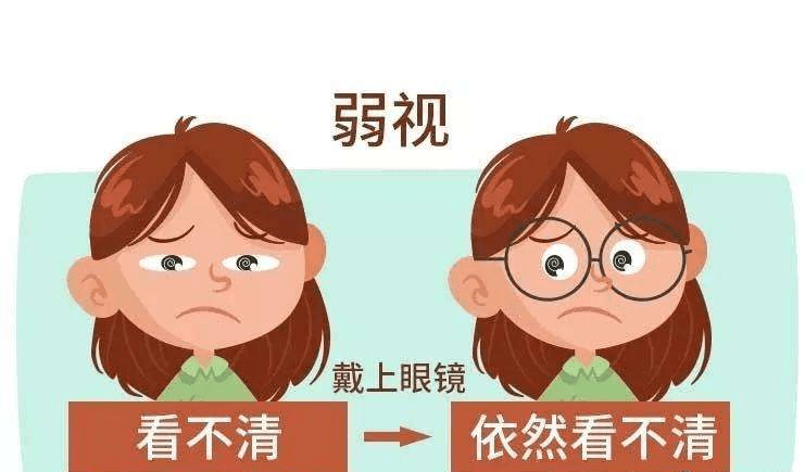 视力|“配镜后，孩子说还是看不清”一位母亲倒出缘由