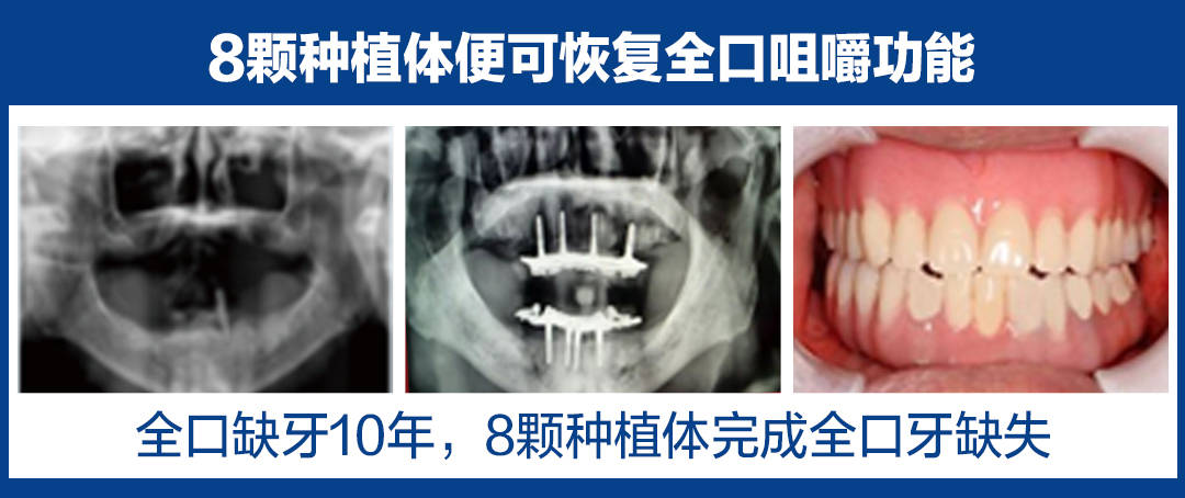 中国人口有多少人缺牙_中国有多少人口