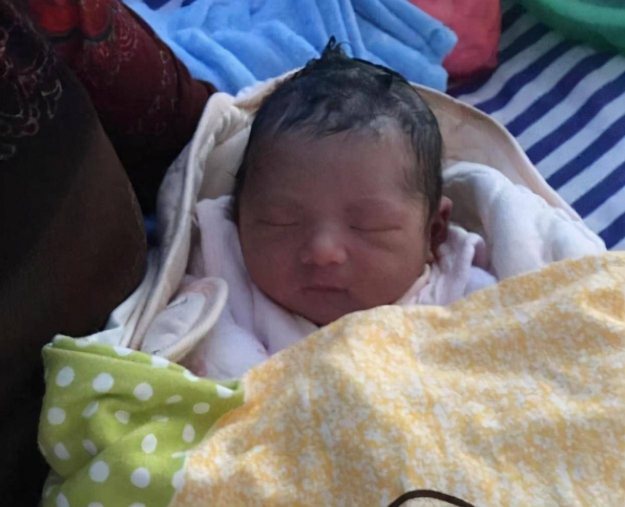 孩子|3个部位越“丑”，长大颜值越高，很少有人三条全中宝刚出生