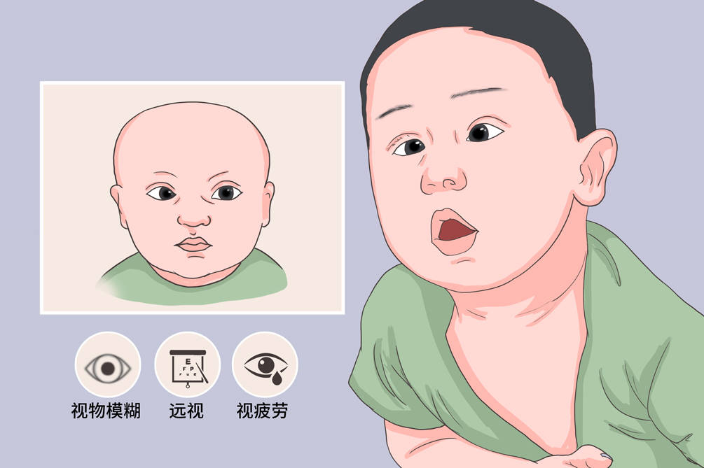 家长发现孩子眼睛往中间偏千万不要大意这可能是内斜视