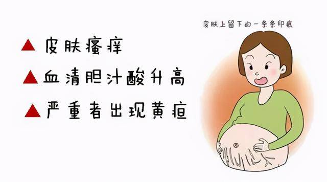 原创妊娠期皮肤瘙痒,原来肝内胆汁淤积症在作怪