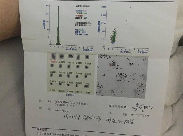 宫颈有癌,月经来"报告",月经出现3个情况,提防宫颈癌变