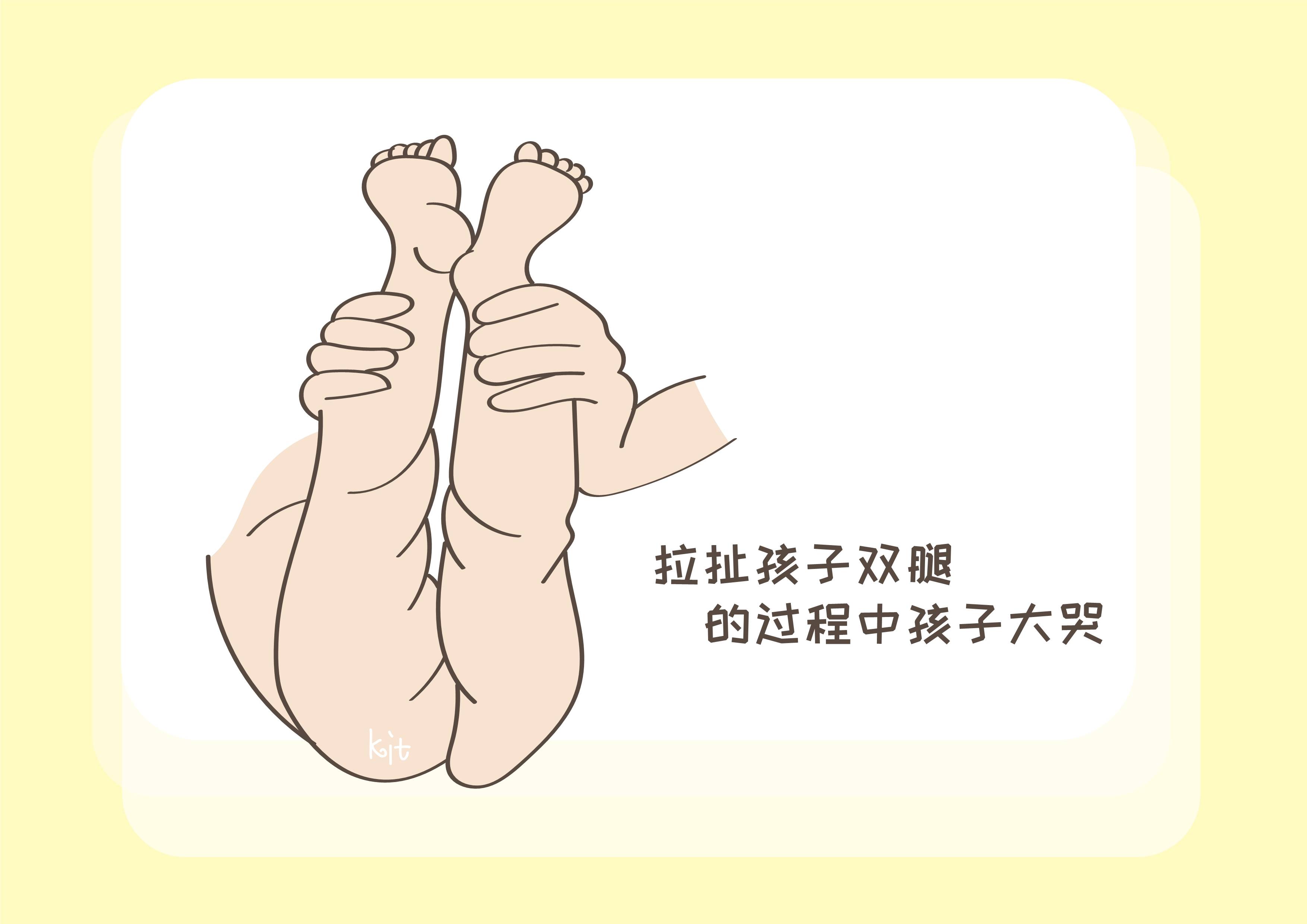 孩子|宝宝的大腿纹为啥不对称？这是什么情况？带你一起了解下