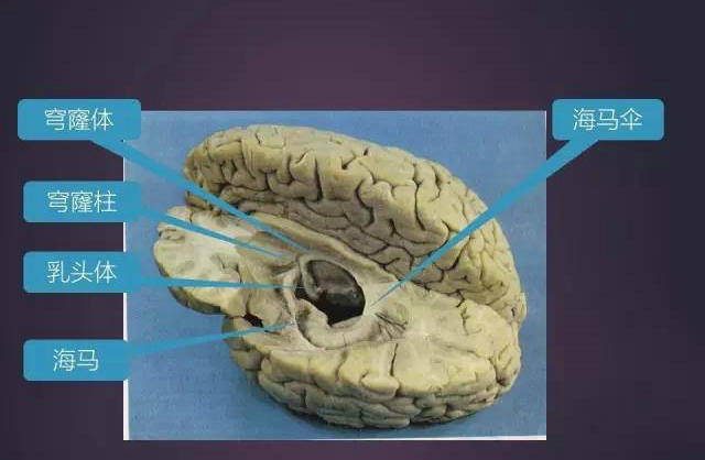 脑由灰质,白质,基底核和脑室等组成.