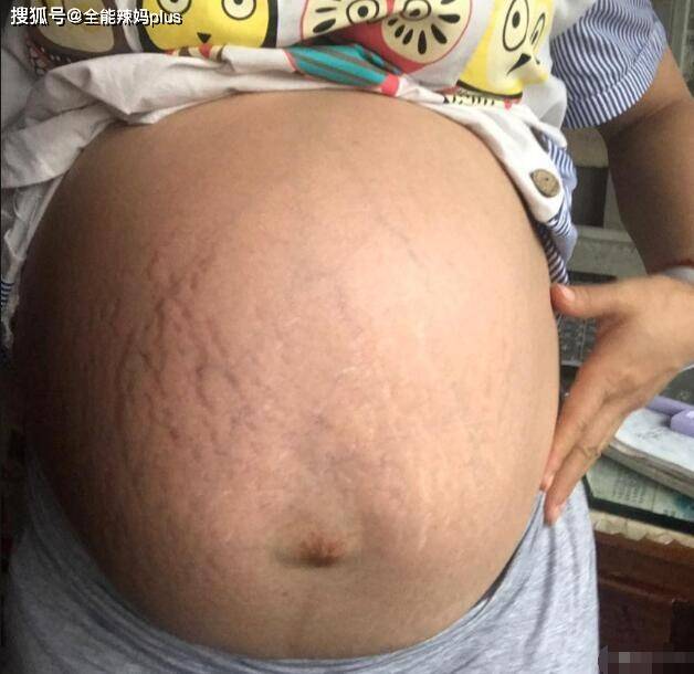 几个月胎儿进入猛涨期 e401300578a84ce6ac79a5291dc8d472.jpeg