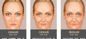 多大年龄开始有法令纹 f8f1812e763346e6b72d3f0a835db7bd.jpeg