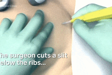 医生手术时，对病人切开的身体都做了什么？3D动画揭秘全过程（组图） - 1