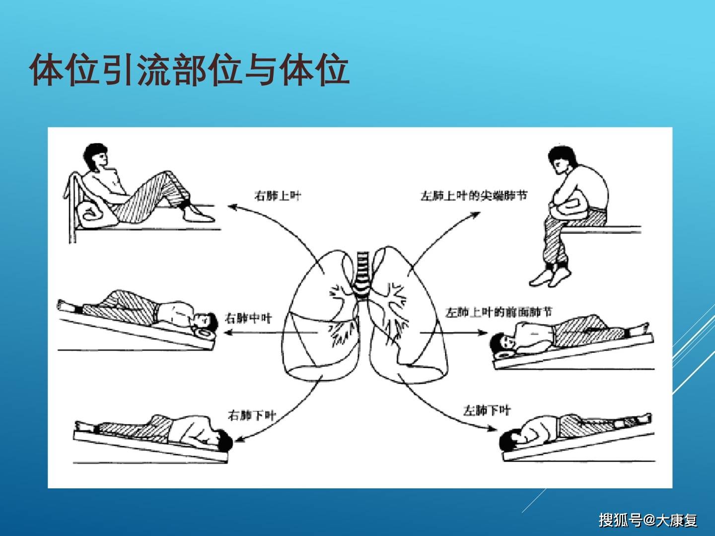 体位摆放松弛训练呼吸训练体位排痰